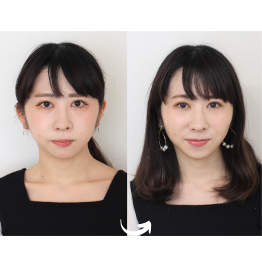 Nさまbefore-after.png